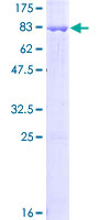 12.5% SDS-PAGE Stained with Coomassie Blue.